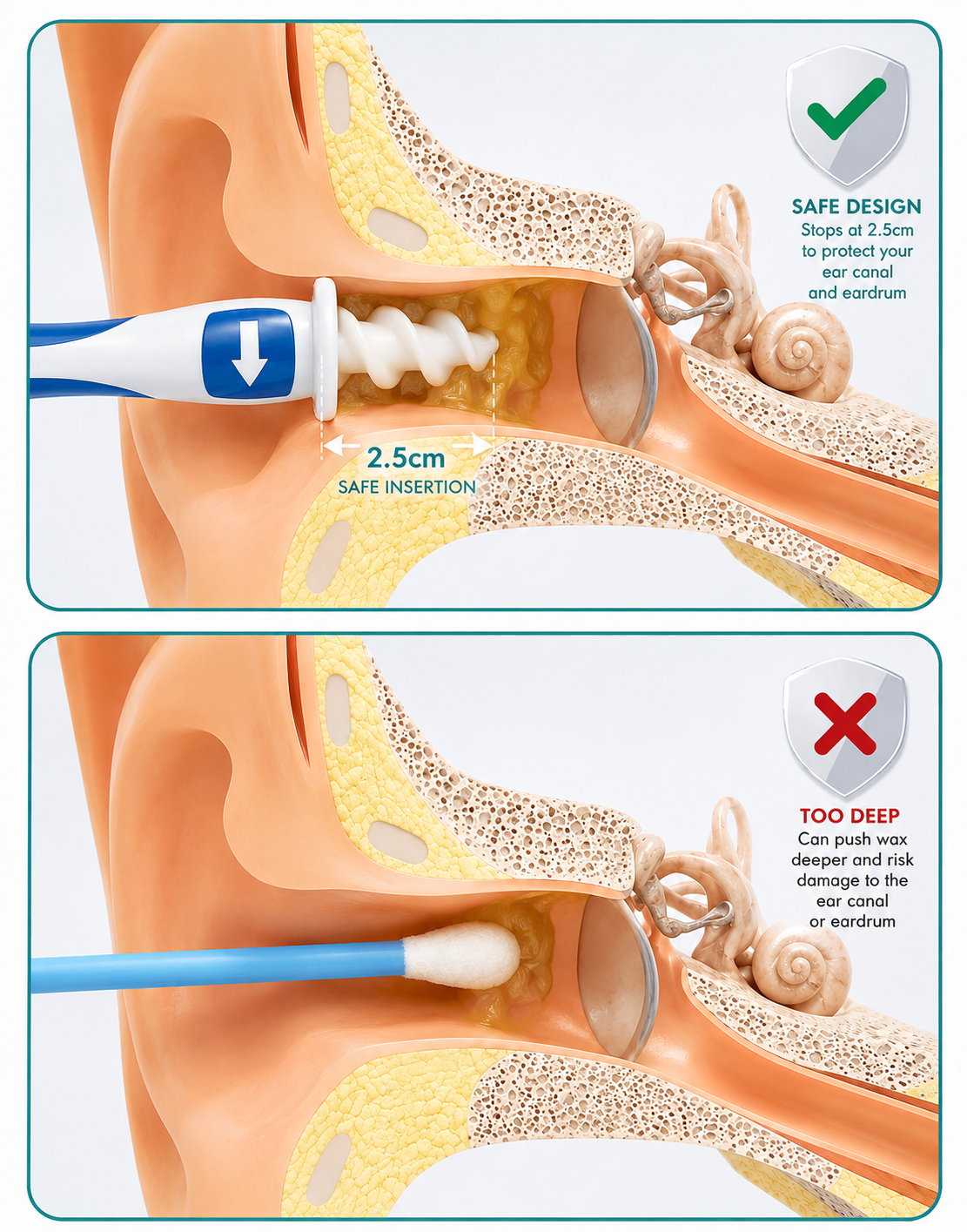Ear Clear Kit